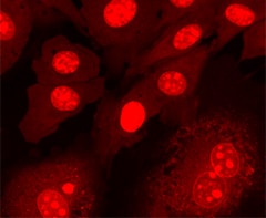nuclear staining of BPAECs