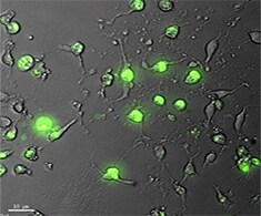 HeLa cells stained with NucGreen® Dead 488 ReadyProbes®