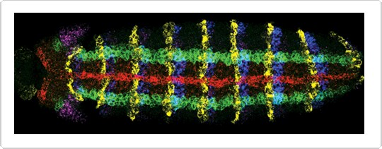 Fluorescence in situ hybridization (FISH)