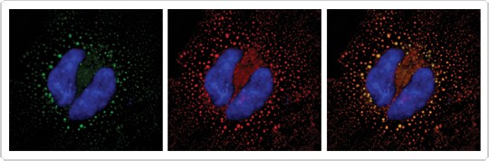 Immunolabeling enhances GFP fluorescence