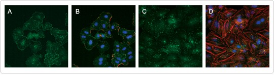 Immunocytochemistry with anti–FAK [pY397] ABfinity™ antibody