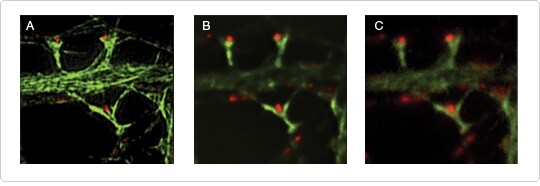 Comparison of super-resolution microscopy with wide-field deconvolution and standard wide-field microscopy