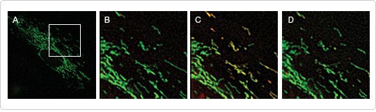 Imaging mitochondrial calcium levels and dynamics