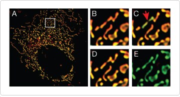 Dynamic imaging of mitochondrial membrane potential