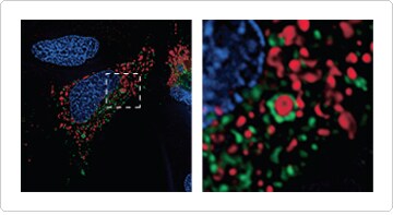 Imaging mitochondrial autophagy in live HeLa cells