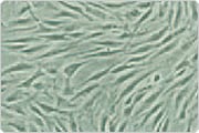 Thin, elongated, bipolar fibroblastic cells on contrasting substrate