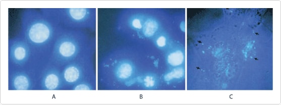 Photomicrographs of mycoplasma-free cultured cells (panel A) and cells infected with mycoplasma (panels B and C)