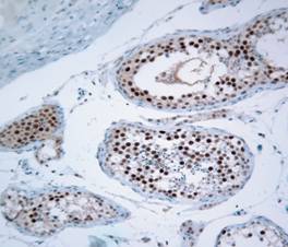 phospho-MAP kinase-positive cells