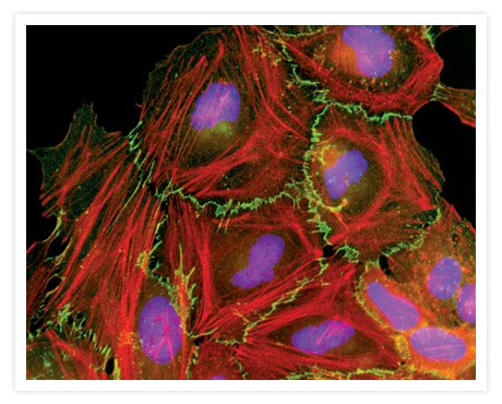 Alpha-catenin in HeLa human cervical cancer cells