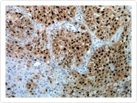 IHC with Anti-p38MAPK Antibody