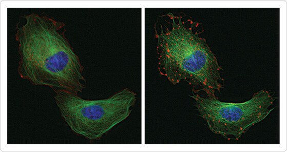 Multiplex imaging of microtubules and microfilaments