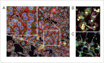 Cytoskeletal and nuclear architecture in breast cancer cells