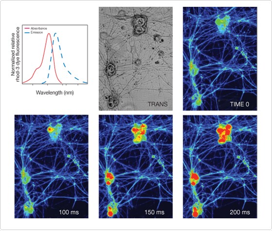 Calcium imaging in neurons loaded with rhod-3 AM 