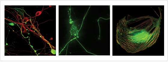 Live-cell imaging with BacMam CellLight® reagents