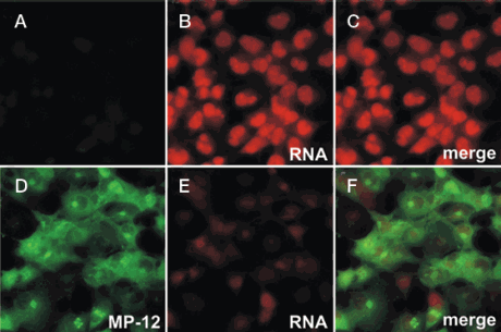 Rift Valley fever virus suppresses host transcription