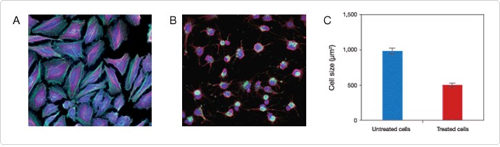 Morphological changes and cytoskeletal rearrangements in HeLa cells after cytochalasin D treatment