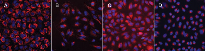 High-content imaging of mitochondria, lysosomes, ER, and Golgi apparatus