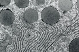 Pathology research Pathology research