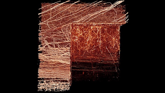 Corner cut through a volume rendering of the axons in the spinal cord Corner cut through a volume rendering of the axons in the spinal cord