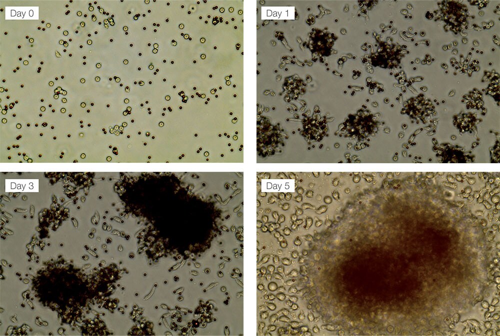 4 panel microscopic images of T cells being activated in culture Countess cell counter images taken at days 0, 1, 3, and 5 showing T cells increasing in culture over time