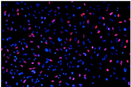 Overlay of 10x image used in the quantitative analysis of proliferating HeLa cells. Overlay of 10x image used in the quantitative analysis of proliferating HeLa cells.