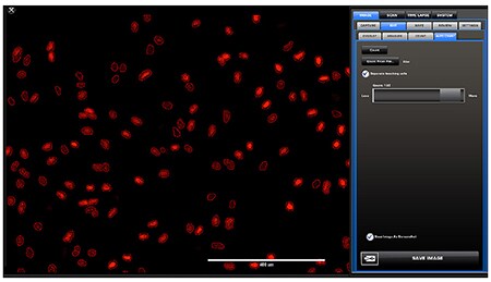 Screen capture of the quantitation of the total population of proliferating cells (red) within the image. Screen capture of the quantitation of the total population of proliferating cells (red) within the image.