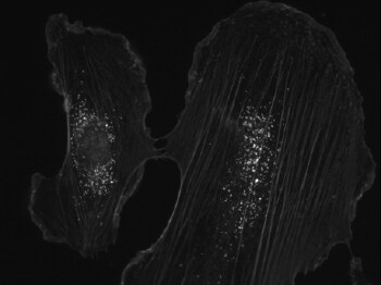 Cell image showing fluorescence from two different color dyes appearing in a single filter set, rendering them indistinguishable in the experiment Cell image showing fluorescence from two different color dyes appearing in a single filter set, rendering them indistinguishable in the experiment