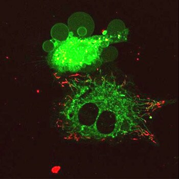 Stained cell image showing two cells: one unhealthy cell showing blebbing next to a healthy cell Stained cell image showing two cells: one unhealthy cell showing blebbing next to a healthy cell