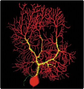 Stained neurons Neurons stained with red polar tracer and green dextran probe shown with co-localization in yellow