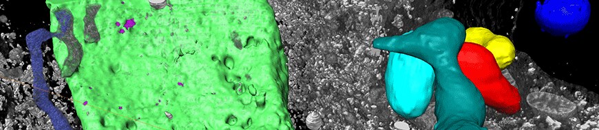 Amira Software for advanced image processing and quantification Amira Software for advanced image processing and quantification