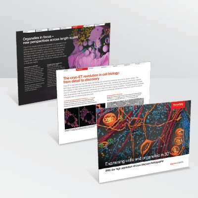 Cryo-Electron Tomography eBook Cryo-Electron Tomography eBook
