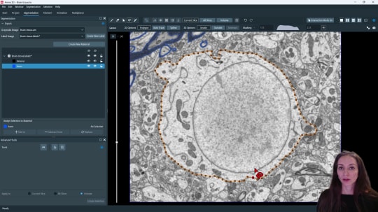How to Use Interactive Segmentation Tools in Segmentation+ Workroom