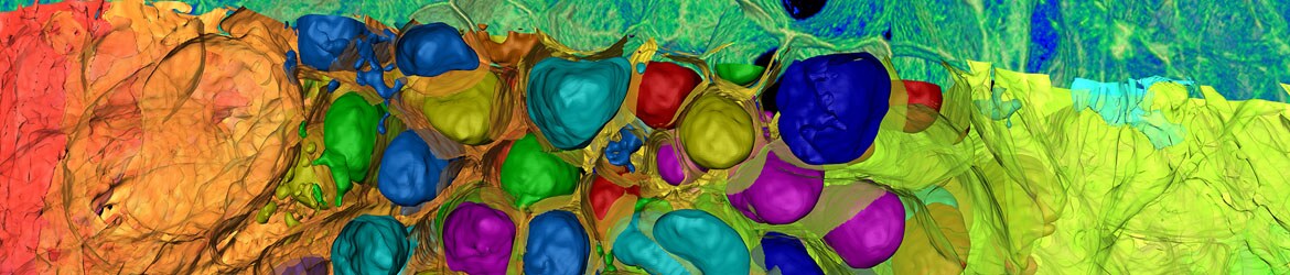 Meet with the Amira Software team at Pasteur Institute Paris Meet with the Amira Software team at Pasteur Institute Paris