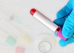 blood sample blood sample