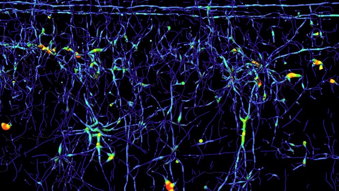 Tube rendering of traced axons colorized according to axon thickness Tube rendering of traced axons colorized according to axon thickness
