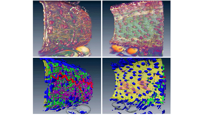 Confocal Microscopy, 3D scan of a mesenteric artery wall Confocal Microscopy, 3D scan of a mesenteric artery wall