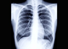 Thermo Fisher Scientific x-ray based technologies Thermo Fisher Scientific x-ray based technologies