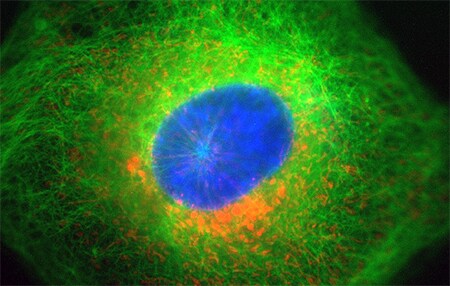 Composite image of step 16 of the Z-stack, indicative of the typical 3-color overlay captured by widefield fluorescence microscopy Composite image of step 16 of the Z-stack, indicative of the typical 3-color overlay captured by widefield fluorescence microscopy