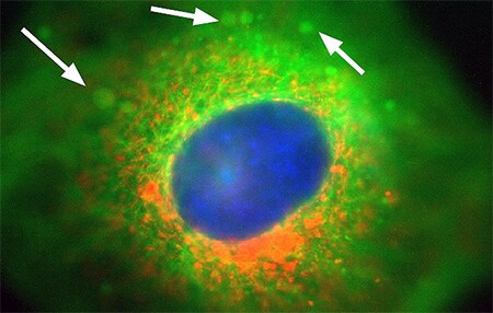 Composite image of step 26 of the Z-stack Composite image of step 26 of the Z-stack