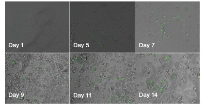 Qualitative time-course monitoring of adipogenesis in live cells by visualization of the adiposomes Qualitative time-course monitoring of adipogenesis in live cells by visualization of the adiposomes