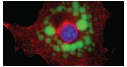 High-resolution spatial imaging of fixed adipocytes High-resolution spatial imaging of fixed adipocytes
