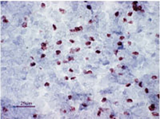 Foxp3 Mouse Spleen IHC Staining Foxp3 Mouse Spleen IHC Staining