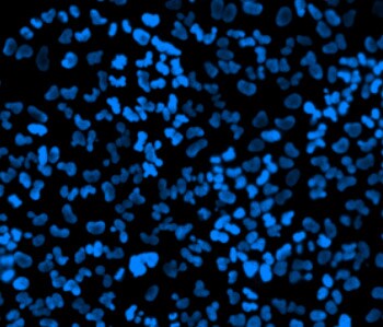 incomplete live-cell nuclear staining incomplete live-cell nuclear staining