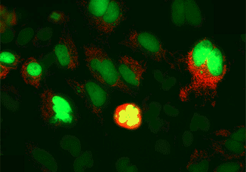 HeLa cells undergoing mitotic division during live cell fluorescent imaging in red and green channels HeLa cells undergoing mitotic division during live cell fluorescent imaging in red and green channels