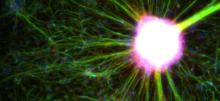 fluorescent cells fluorescent cells mounted with SlowFade antifade medium