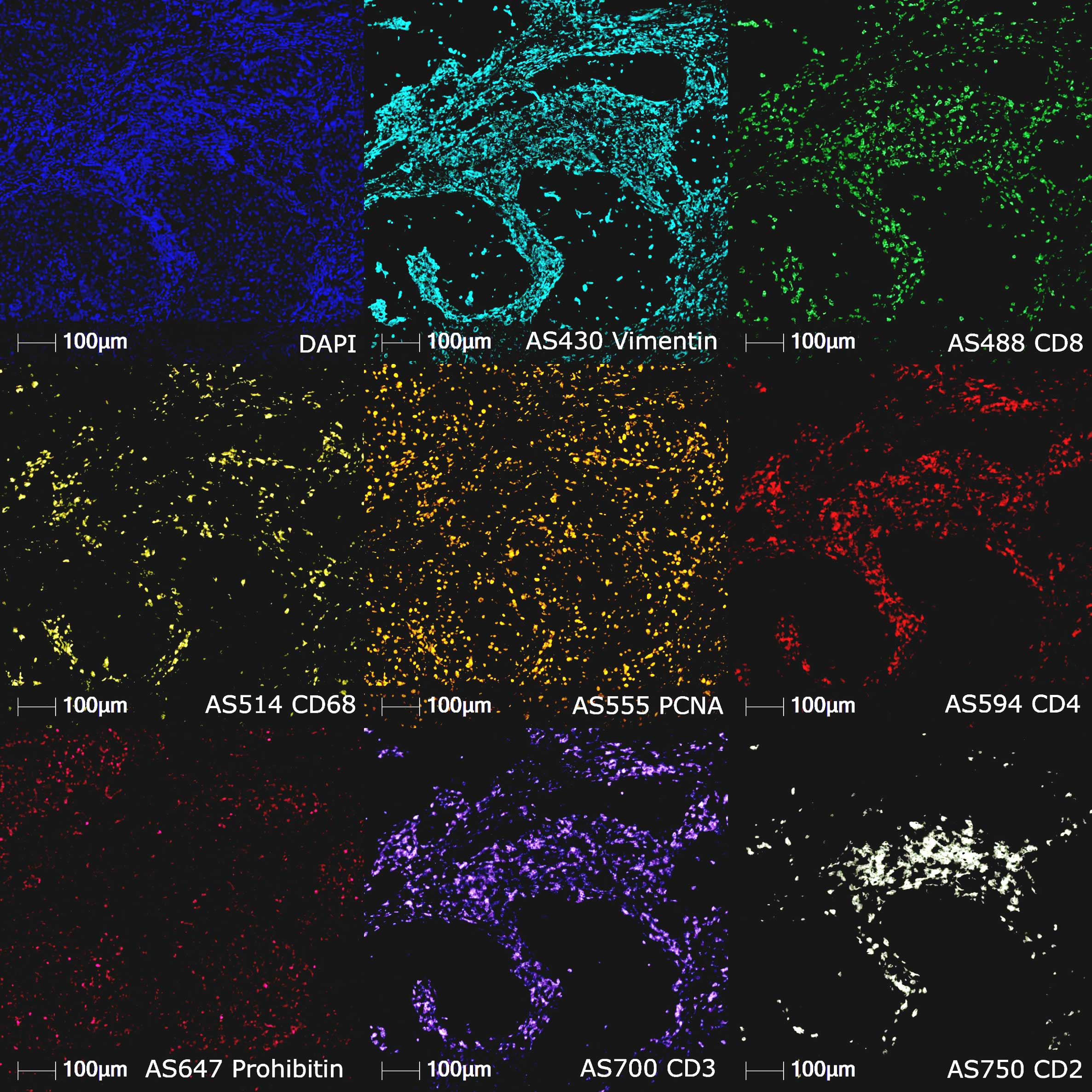 Tile montage representing all channels from the Aluora Spatial Rainbow Kit plus DAPI 9-panel fluorescence microscopy image