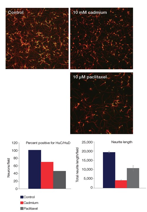 Neuronal toxicity results microscopic images of fluorescence-stained cultured neurons and graphs of cell toxicity and neurite length with 3 different treatments