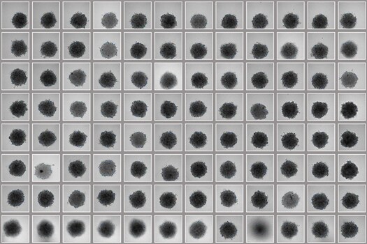 Culture results from A549 spheroids Microscopy image of individual spheroids growing in wells of a 96-well Nunclon Sphera plate