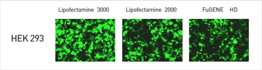 Lipofectamine 3000 fluorescent micrographs Fluorescent micrographs showing GFP transfection in cells transfected using Lipofectamine 3000 reagent, Lipofectamine 2000 reagent, and FuGene HD. Cells transfected with Lipofectamine 3000 reagent show the greatest GFP activity.
