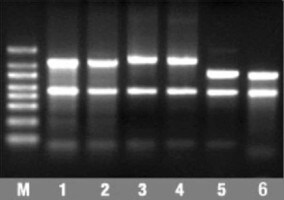 RNA electrophoresis for northern blotting RNA bands on a gel